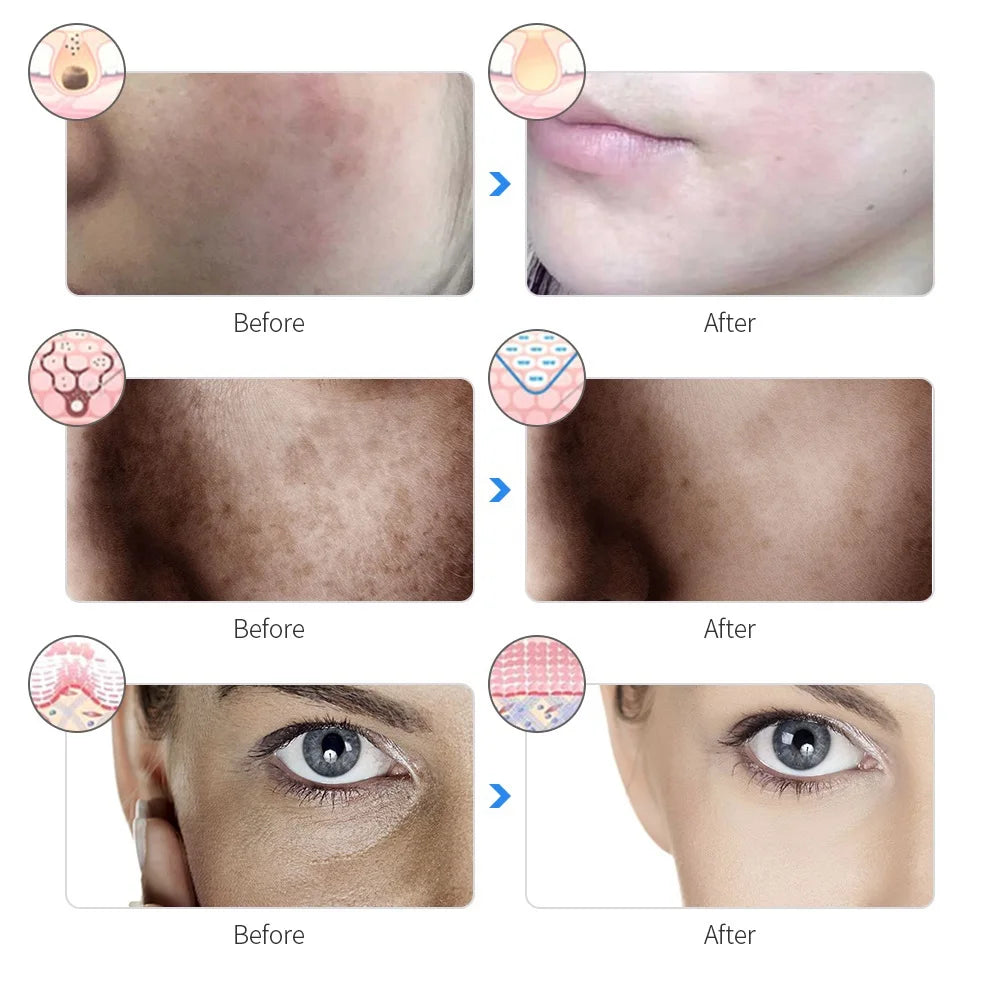 AuraHaven Rechargeable Facial LED Mask